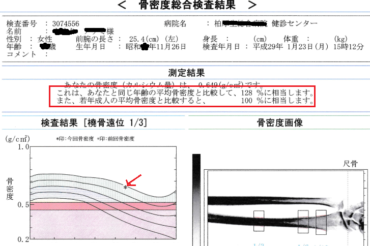 骨密度